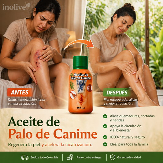 Aceite de palo de canime: Reduce dolor y mejora circulación